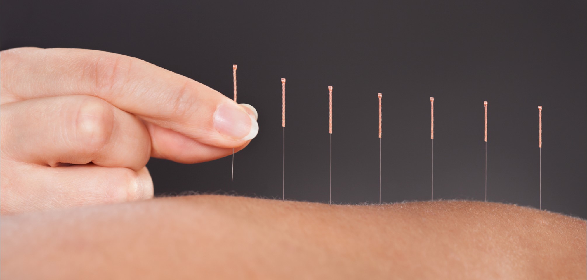 acupuncture st sauveur